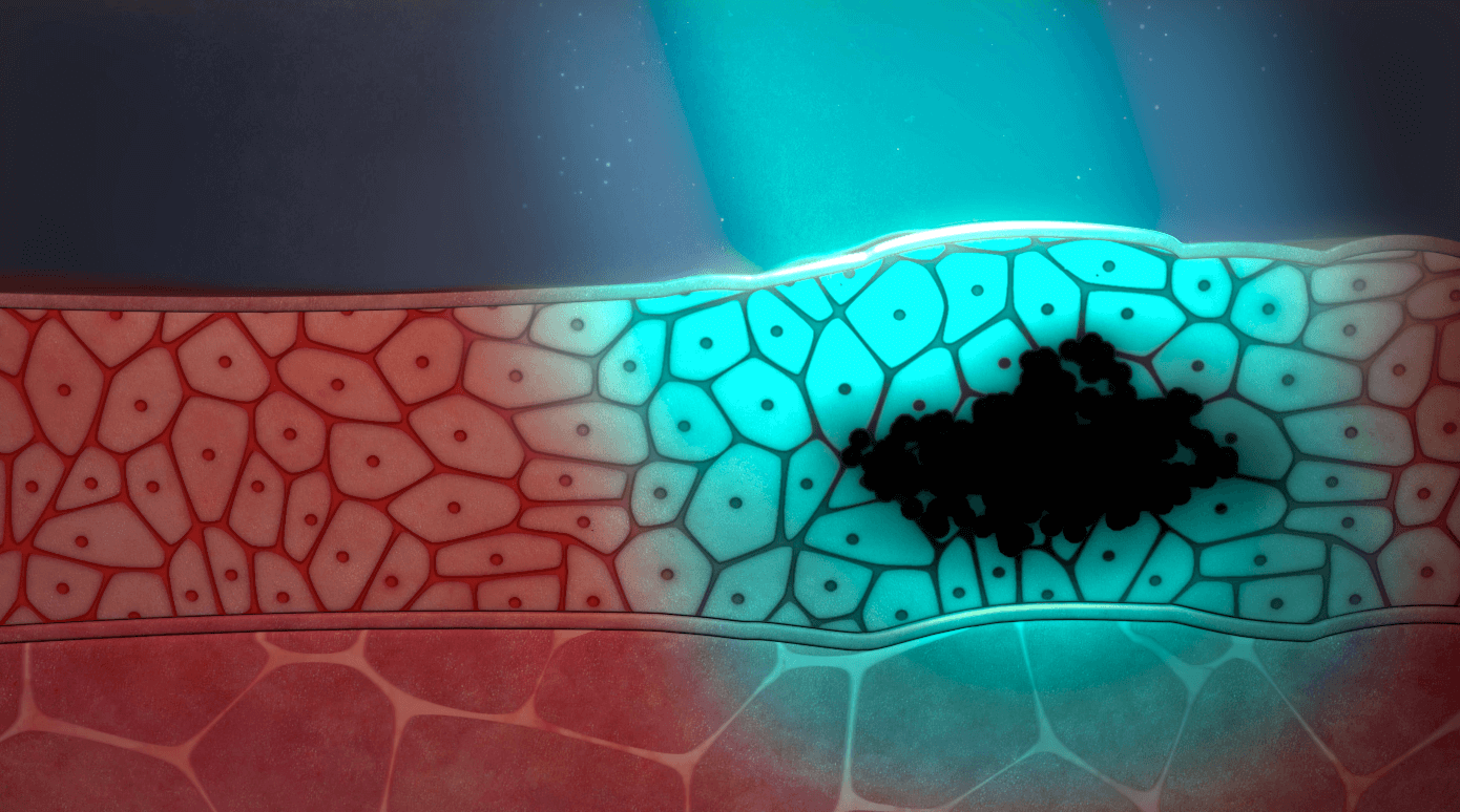 Oral Cancer Screening