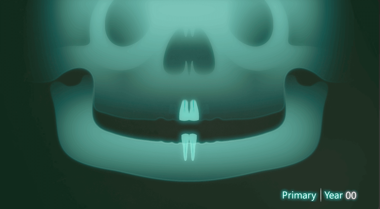 Sequence of Tooth Eruption