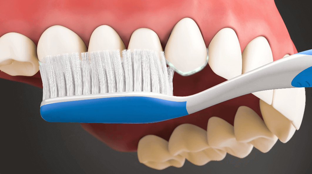 Proper Tooth Brushing Technique