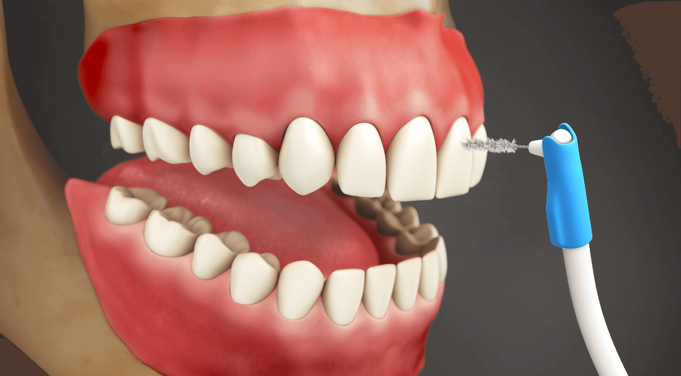 Special Aids Proxabrush