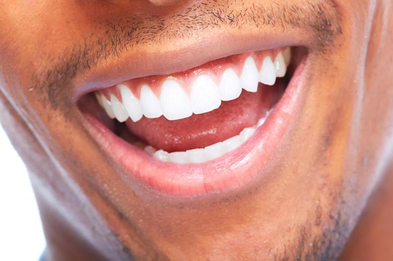 Dental cleaning at DDS Group